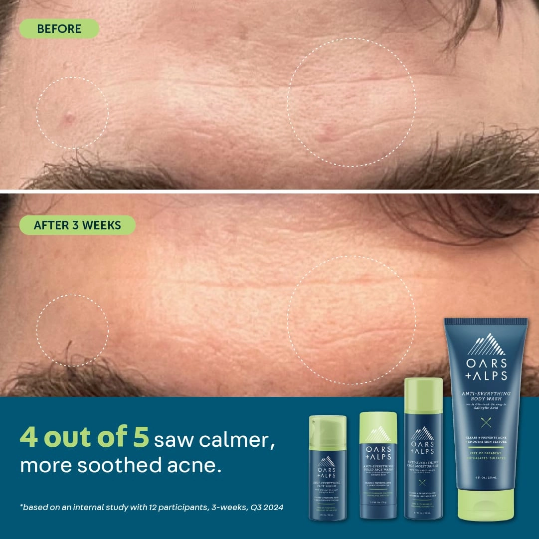 Anti-Everything Face Moisturizer