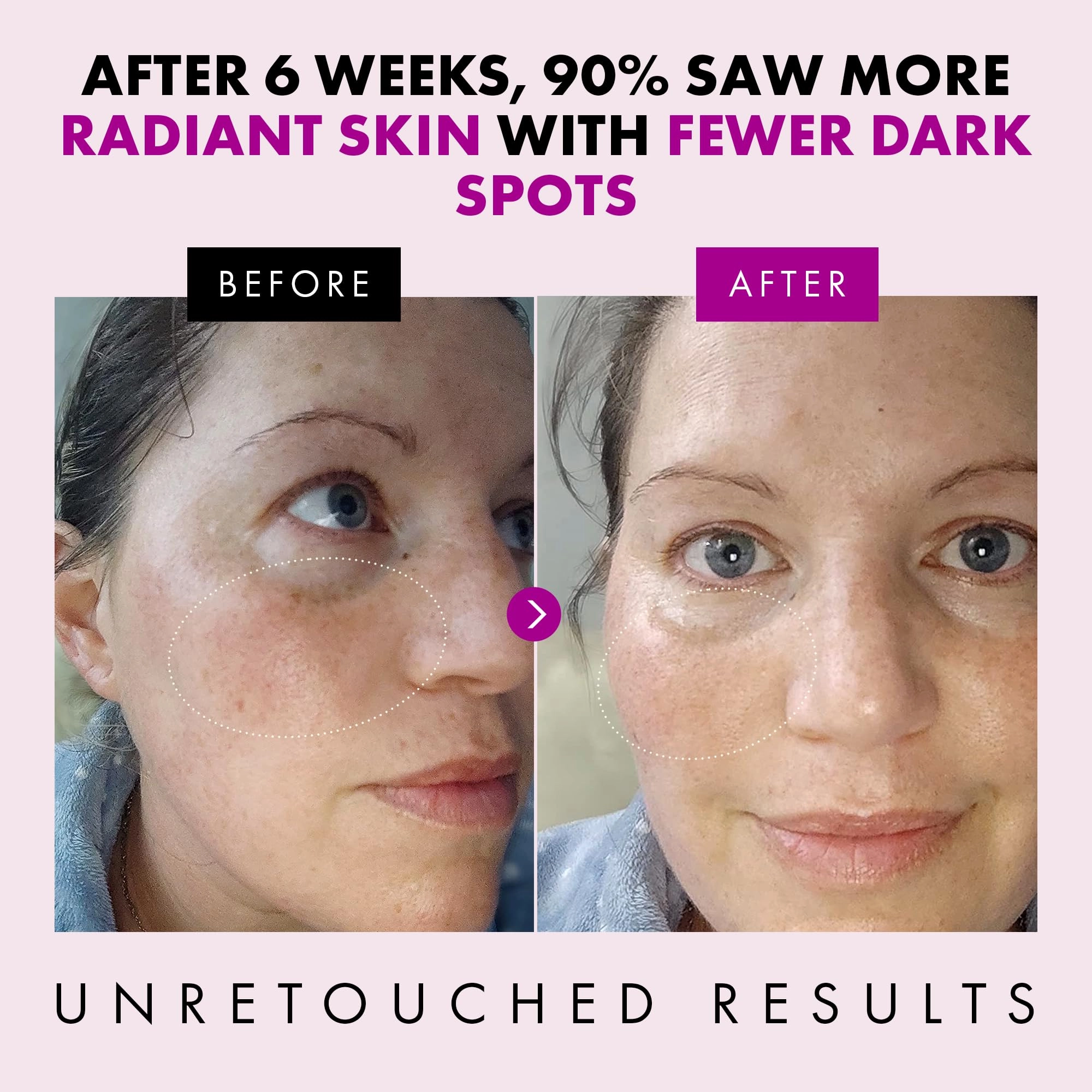 Collagen Anti Aging Face Cream with Patented Matrixyl-3000 & Argireline - 5x More Powerful w/ Pep-Boost Peptide Complex   10 Antioxidants - Facial Wrinkle Day/Night Cream Face Moisturizer for Women