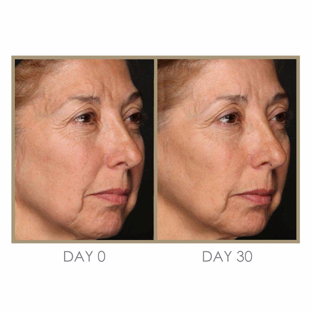 Dream Cream Moisturizing Treatment by Genie Beauty (Ships in 2-3 Weeks)