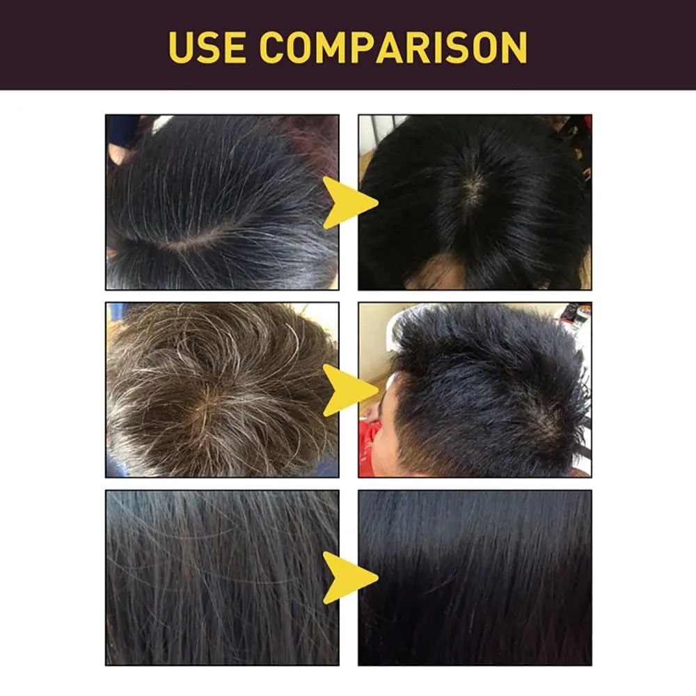 Revitalcolor Shampoo Cubre Canas, Revitacolor Shampoo, Revitalcolor Natural Black Hair Dye 𝐒𝐡𝐚𝐦𝐩𝐨𝐨 3-in-1, Instant Gray Coverage for Men & Women (Wine Red)